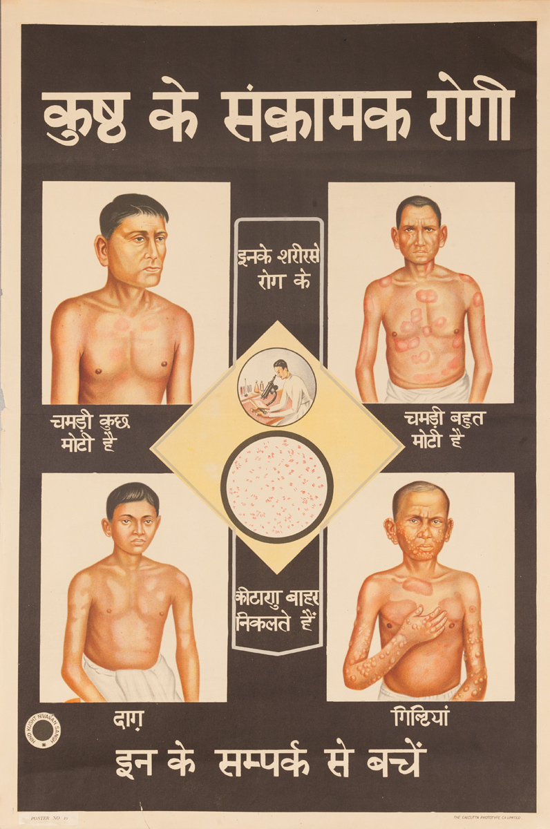 Original India Leprosy Poster, Hindi