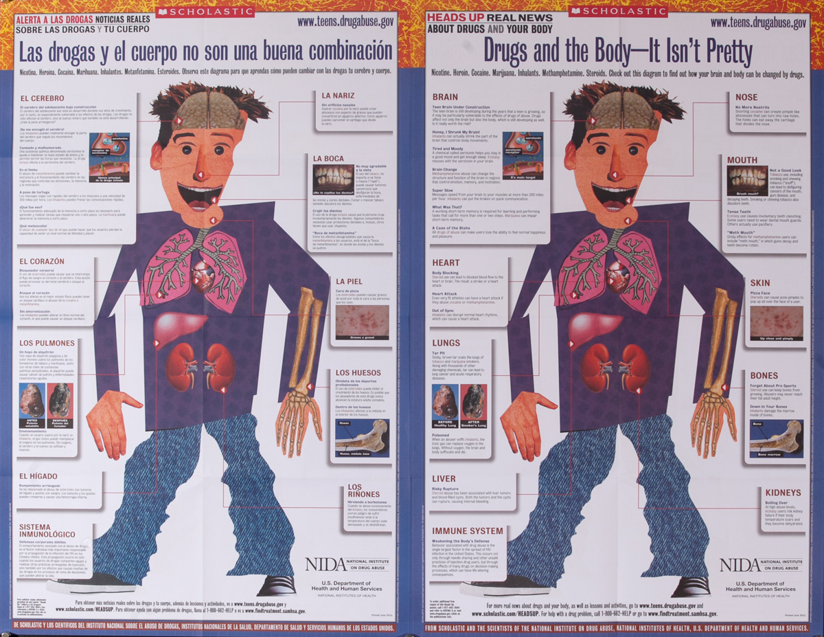 Drugs and the Body - It isn't Pretty, Original American 2 Sided Health  Poster