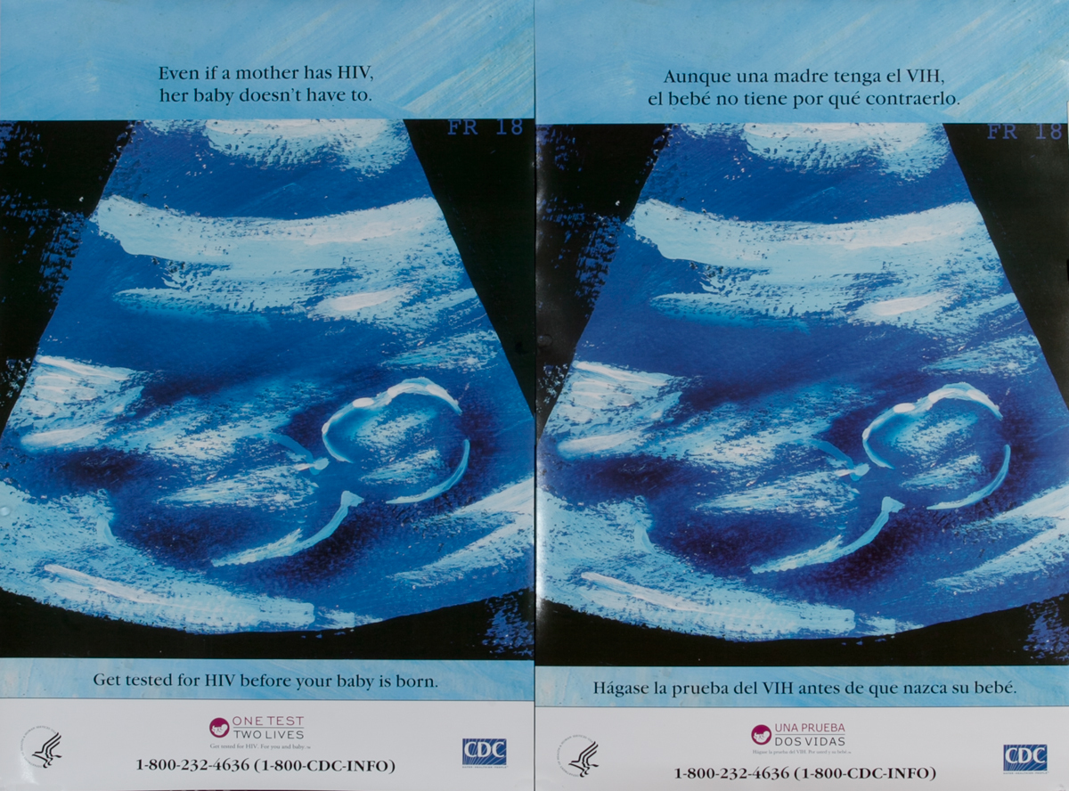 Even if a Mother has HIV, her baby doesn't have to. Original Centers for Disease Control and Prevention Health Poster