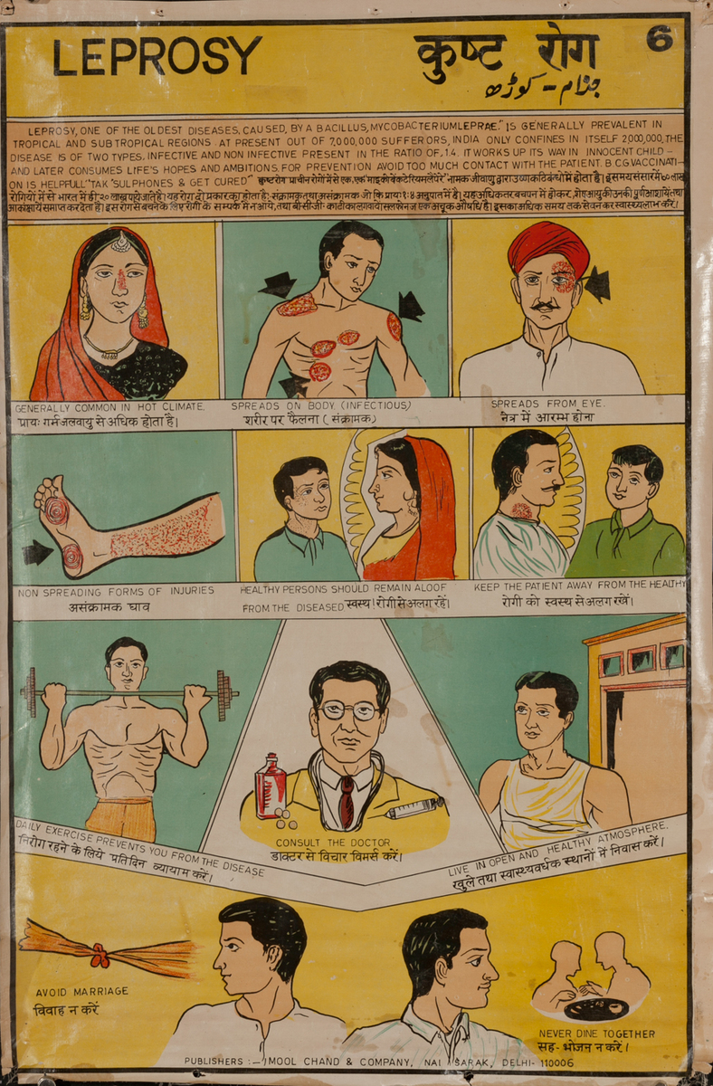 Indian Leprosy Medical Poster #6